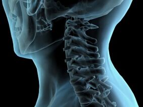 a felső gerinc osteochondrosisának kezelése